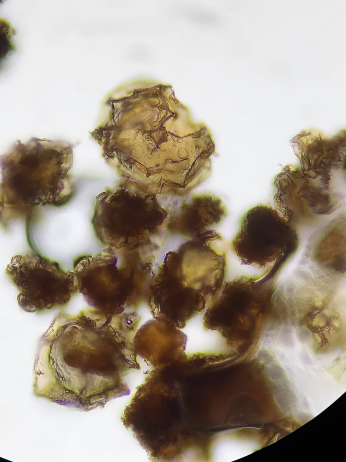 Spores of Diplazium x subternatum